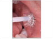 oral-cdx.jpg